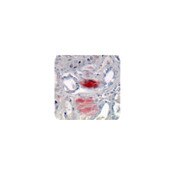 Amyloid Stain Kit (Congo Red)